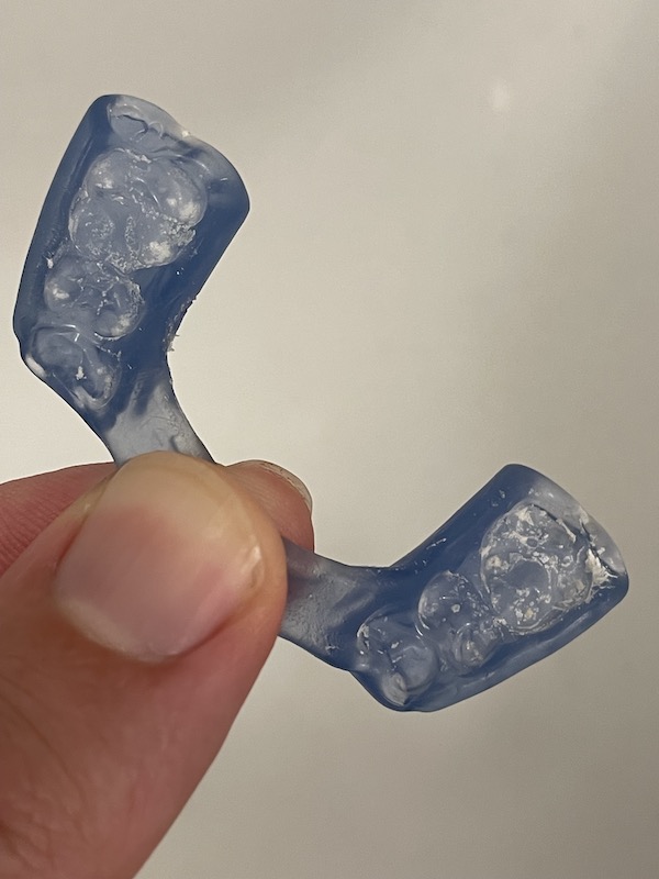  image of calcium deposits on an over the counter mouthguard