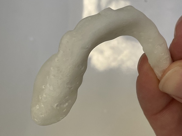 discolored night guard, time to replace