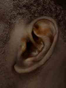 Picture of ear representing ear ache
